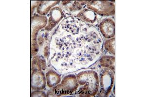 VPS54 Antibody (Center) (ABIN656860 and ABIN2846065) immunohistochemistry analysis in formalin fixed and paraffin embedded human kidney tissue followed by peroxidase conjugation of the secondary antibody and DAB staining.