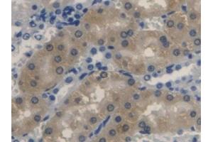 Detection of BLVRA in Rat Kidney Tissue using Polyclonal Antibody to Biliverdin Reductase A (BLVRA)