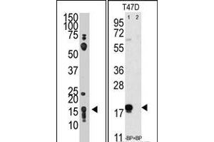 Image no. 1 for anti-CD90 (THY1) (N-Term) antibody (ABIN357443) (CD90 anticorps  (N-Term))
