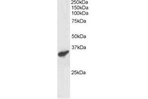Image no. 1 for anti-Polycomb Group Ring Finger 3 (PCGF3) (C-Term) antibody (ABIN374301) (PCGF3 anticorps  (C-Term))