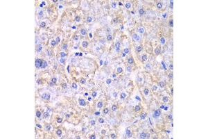 Immunohistochemistry of paraffin-embedded human liver injury using EHHADH antibody (ABIN6292474) at dilution of 1:100 (40x lens). (EHHADH anticorps)