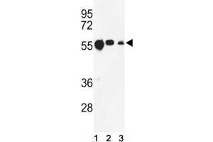 Western blot analysis of anti-beta Tubulin antibody and (1) CEM, (2) MCF-7, and (3) MDA-MB231 lysate. (TUBB1 anticorps)