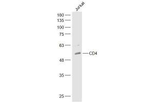 Human Jurkat lysates probed with CD4 Polyclonal Antibody, Unconjugated  at 1:300 dilution and 4˚C overnight incubation.