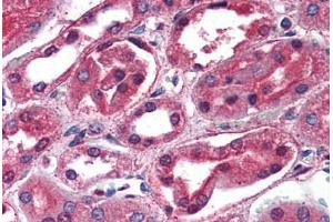 Kidney: Formalin-Fixed, Paraffin-Embedded (FFPE) (SCNN1G anticorps  (C-Term))