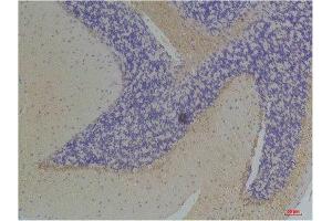 Immunohistochemistry (IHC) analysis of paraffin-embedded Mouse Brain Tissue using KChIP3 Rabbit Polyclonal Antibody diluted at 1:200.