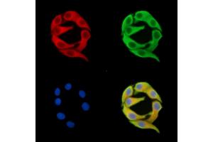 ABIN7096163 and ABIN7100225 staining Hela cells by IF/ICC. (AIDA anticorps)