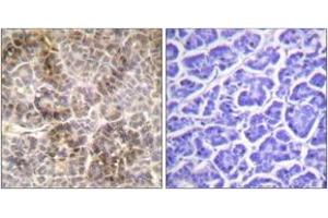 Immunohistochemistry analysis of paraffin-embedded human pancreas, using Moesin/Ezrin/Radixin (Phospho-Thr558) Antibody. (Moesin/ezrin/radixin (AA 524-573), (pThr558) anticorps)