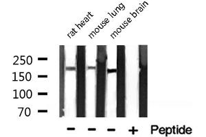 Western blot analysis of Integrin β4 expression in various lysates