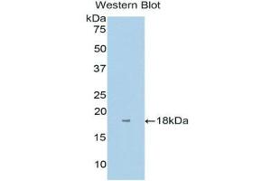 Western Blotting (WB) image for anti-Interleukin 1 Receptor Accessory Protein (IL1RAP) (AA 420-558) antibody (ABIN3202838) (IL1RAP anticorps  (AA 420-558))