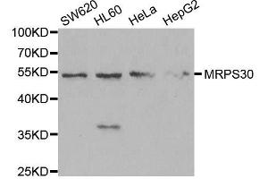 Western blot analysis of extracts of various cell lines, using MRPS30 antibody. (MRPS30 anticorps  (AA 190-439))