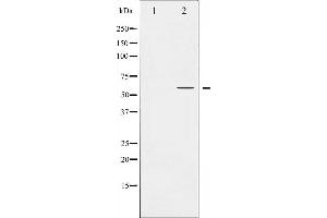 Western blot analysis of PPAR-gamma expression in HuvEc whole cell lysates,The lane on the left is treated with the antigen-specific peptide. (PPARG anticorps  (Internal Region))