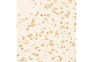 Immunohistochemistry of paraffin embedded mouse brain using SCN4b (ABIN7075646) at dilution of 1:2000 (300x lens) (SCN4B anticorps)