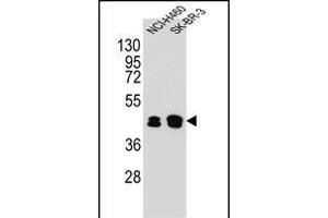 KRT80 Antibody (C-term) (ABIN654828 and ABIN2844502) western blot analysis in NCI-,SK-BR-3 cell line lysates (35 μg/lane). (KRT80 anticorps  (C-Term))