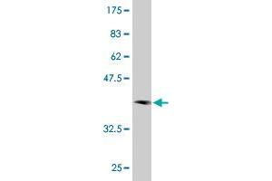 Western Blot detection against Immunogen (37.