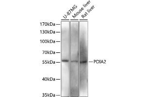 Western blot analysis of extracts of various cell lines, using PDI antibody (ABIN6128422, ABIN6145387, ABIN6145388 and ABIN6216541) at 1:3000 dilution. (PDIA2 anticorps  (AA 326-525))