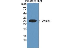 Figure. (SCUBE3 anticorps  (AA 807-993))