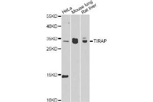 Western blot analysis of extracts of various cell lines, using TIRAP antibody. (TIRAP anticorps)
