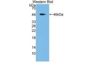 Detection of Recombinant MBP, Rat using Monoclonal Antibody to Major Basic Protein (MBP)
