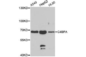 Western blot analysis of extracts of various cell lines, using C4BPA antibody (ABIN2736376) at 1:1000 dilution. (C4BPA anticorps)