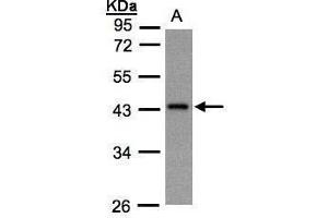 WB Image Sample(30 ug whole cell lysate) A:Hep G2 , 10% SDS PAGE antibody diluted at 1:1000