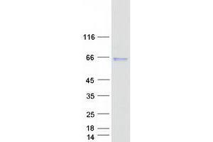Validation with Western Blot