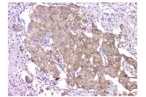IHC analysis of WWOX using anti-WWOX antibody (ABIN6719627). (WWOX anticorps  (AA 1-245))