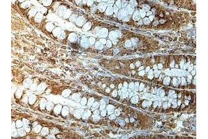 Immunohistochemistry (IHC) image for anti-Makorin Ring Finger Protein 3 (MKRN3) antibody (ABIN1855943) (MKRN3 anticorps)