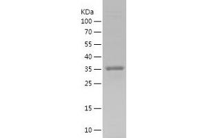Western Blotting (WB) image for Solute Carrier Family 2 (Facilitated Glucose Transporter), Member 3 (SLC2A3) (AA 449-496) protein (His-IF2DI Tag) (ABIN7125155)