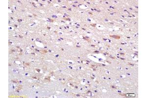 Formalin-fixed and paraffin embedded rat brain labeled with Anti-HIP2 Polyclonal Antibody, Unconjugated (ABIN1387369) at 1:200 followed by conjugation to the secondary antibody and DAB staining. (UBE2K anticorps  (AA 51-150))