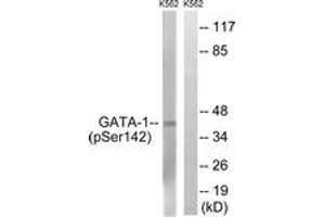 Western blot analysis of extracts from K562 cells, using GATA1 (Phospho-Ser142) Antibody. (GATA1 anticorps  (pSer142))