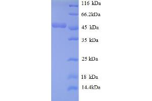SDS-PAGE (SDS) image for ATP Synthase, H+ Transporting, Mitochondrial F1 Complex, O Subunit (ATP5O) (AA 24-213) protein (GST tag) (ABIN5712277)