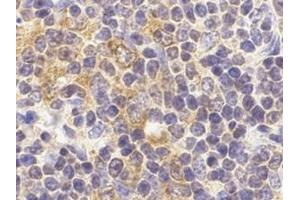 Immunohistochemistry of TLR9 in mouse spleen cells with this product at 2 μg/ml.