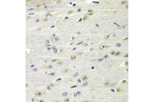 Immunohistochemistry of paraffin-embedded mouse brain using FMRP Antibody (ABIN6127908, ABIN6140718, ABIN6140720 and ABIN6221284) at dilution of 1:100 (40x lens).