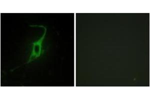 Immunofluorescence analysis of NIH-3T3 cells, using CDH20 Antibody. (Cadherin 20 anticorps  (AA 111-160))