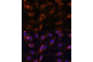 Immunofluorescence analysis of C6 cells using SC antibody (ABIN7270188) at dilution of 1:100. (SCAMP2 anticorps  (AA 1-152))
