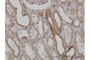 Image no. 4 for anti-Mitofusin 2 (MFN2) (AA 661-758) antibody (ABIN599101) (MFN2 anticorps  (AA 661-758))