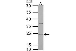 WB Image CD74 antibody [N1N2], N-term detects CD74 protein by Western blot analysis. (CD74 anticorps  (N-Term))