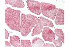 Human Skeletal Muscle: Formalin-Fixed, Paraffin-Embedded (FFPE). (RRP8 anticorps  (AA 89-138))