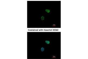 ICC/IF Image Immunofluorescence analysis of paraformaldehyde-fixed HeLa, using PSMC6, antibody at 1:500 dilution. (PSMC6 anticorps)