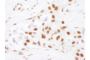 Immunohistochemistry (IHC) image for anti-Interleukin enhancer-binding factor 3 (ILF3) (AA 652-702) antibody (ABIN7453923)