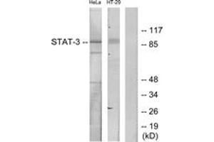 Western blot analysis of extracts from HeLa/HT-29 cells, using STAT3 (Ab-727) Antibody. (STAT3 anticorps  (AA 694-743))