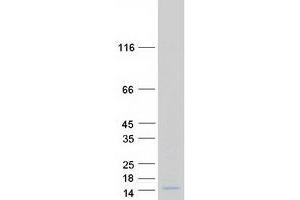 Validation with Western Blot