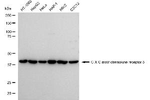 Western blotting analysis using C-X-C motif chemokine receptor 5 antibody (ABIN7798047).