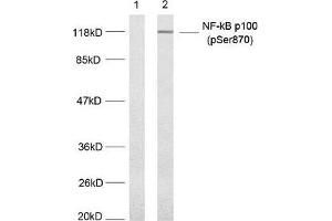 Western blot analysis of extract from MDA-MB-435 cells untreated or treated with TNF-alpha, (20 ng/mL, 5 min) using NF-κ,B p100(phospho-Ser870) antibody.