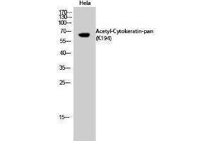 Western Blotting (WB) image for anti-Keratin 1 (KRT1) (acLys194) antibody (ABIN3181898) (Cytokeratin 1 anticorps  (acLys194))