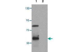 Western blot analysis of RASSF10 in human lung tissue lysate with RASSF10 polyclonal antibody  at 1 ug/mL. (RASSF10 anticorps  (N-Term))