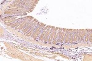 Immunohistochemistry analysis of paraffin-embedded rat colon using,KIF5B (ABIN7074440) at dilution of 1: 1000