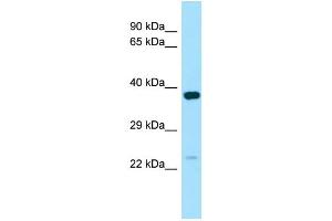 WB Suggested Anti-NXNL1 Antibody Titration: 1. (NXNL1 anticorps  (C-Term))