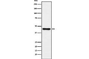 Western blot analysis of ABHD5 expression in HepG2 cell lysate.