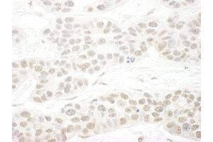 Immunohistochemistry (IHC) image for anti-SET Domain Containing 1B (SETD1B) (AA 350-400) antibody (ABIN7448602)